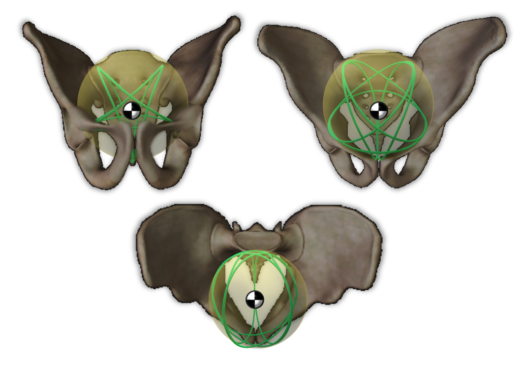 The Pelvic Aster from 3 different views